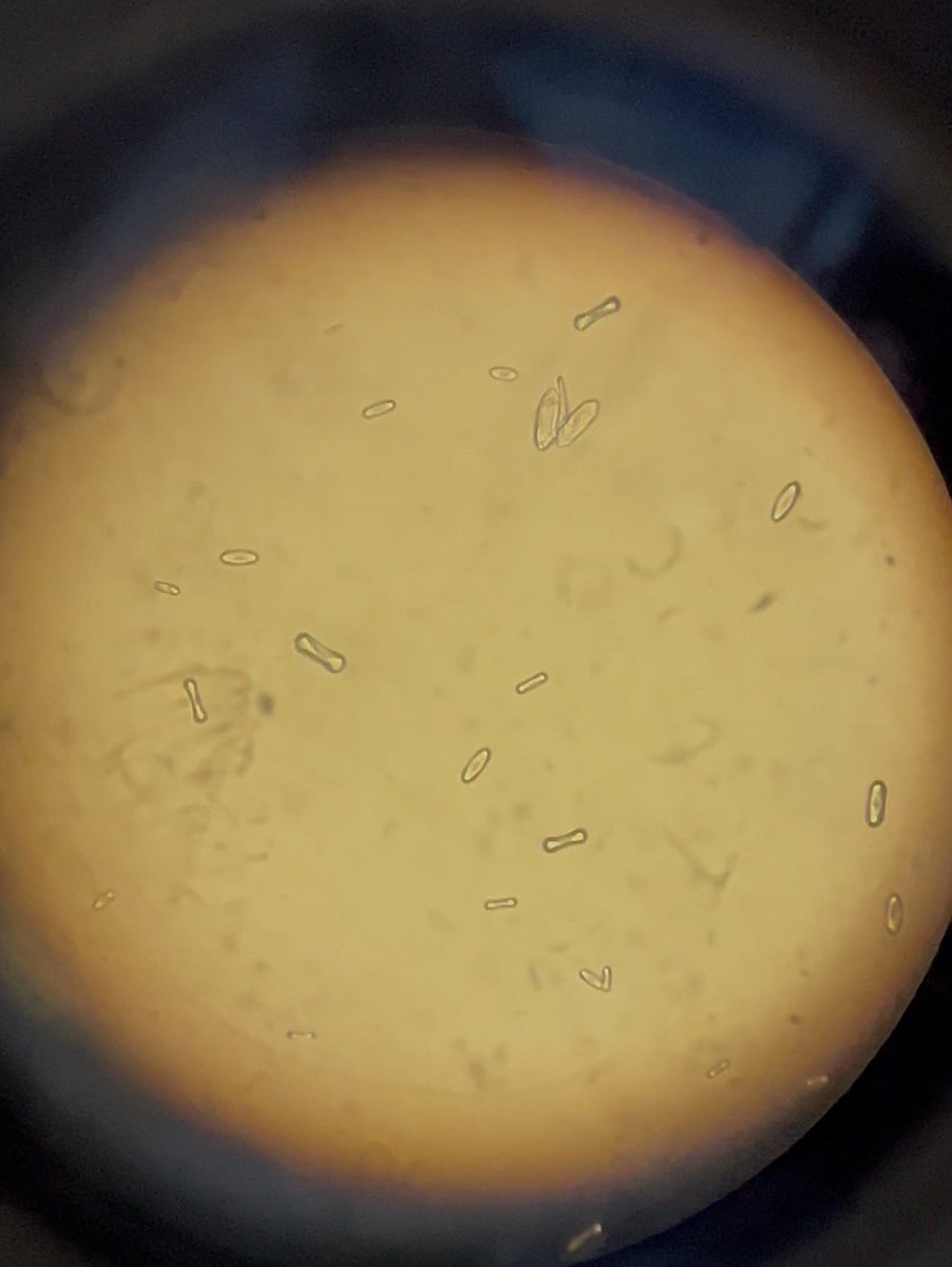 Ahoud_AlD's tweet photo. صورةةة من عدسه المايكرو 🔎🔎
Calcium carbonate 🔥
#مختبرات #مايكرو #مختبرجية https://t.co/63zjfYtX52
