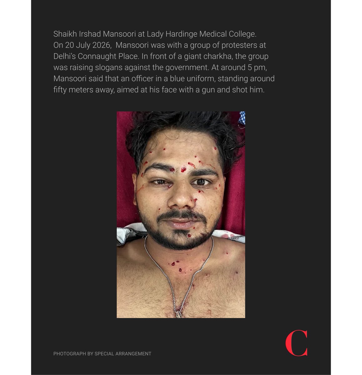 thecaravanindia's tweet photo. “Its particles, its pellets, its pieces penetrated all over my face,” Shaikh Irshad Mansoori, a protester said, adding that it also struck him in his neck and shoulders. “And suddenly there I was bleeding a lot from my face, my shoulders and my neck,” he said. The Rapid Action Force, which comes under the Central Reserve Police Force, and which was deployed that day, dons a blue uniform.

Read the entire report by Shahid Tantray (@shahidtantray): https://t.co/2IWf71WJpl