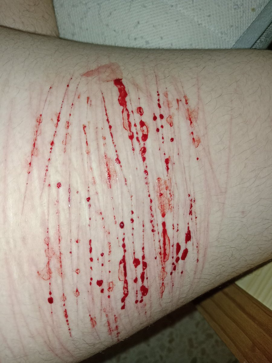 MindOnPause's tweet photo. Twitter made me delete this shit
IT'S SFX, IT'S FAKE (whatever ppl say to not get it deleted) IT'S ALL FAKE

Finally understood how to make this razor work #slitwt #slittwt #988twt https://t.co/ZcZDGbtH38