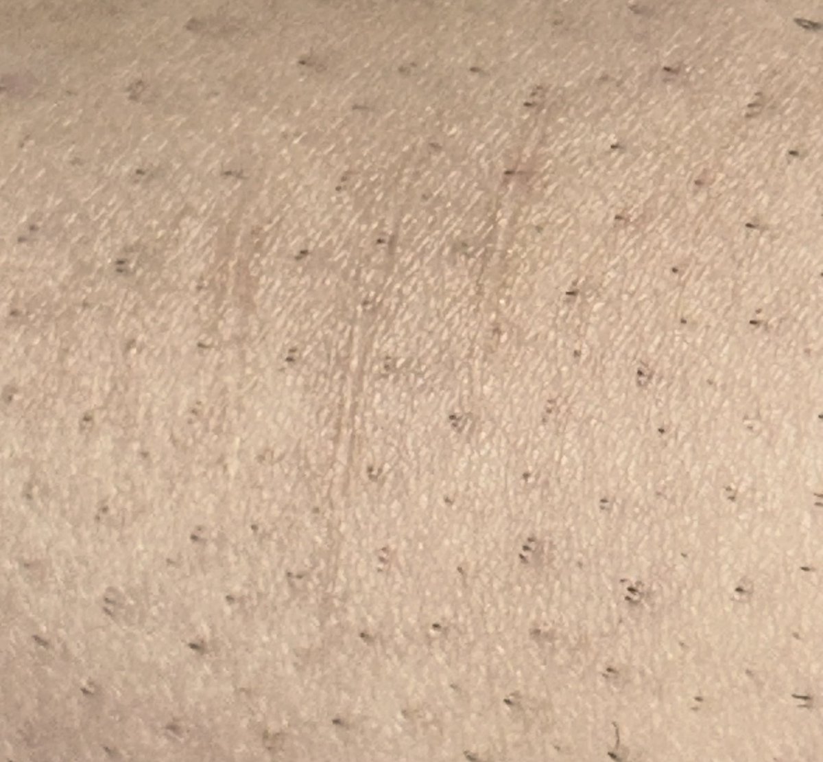 lainlainlainnn's tweet photo. I hate my scars I wish they were more noticeable and I’ve been clean for a month I just want to relapse tf #shtwt #shedtwt #slittwt https://t.co/IEv0wlUjpy