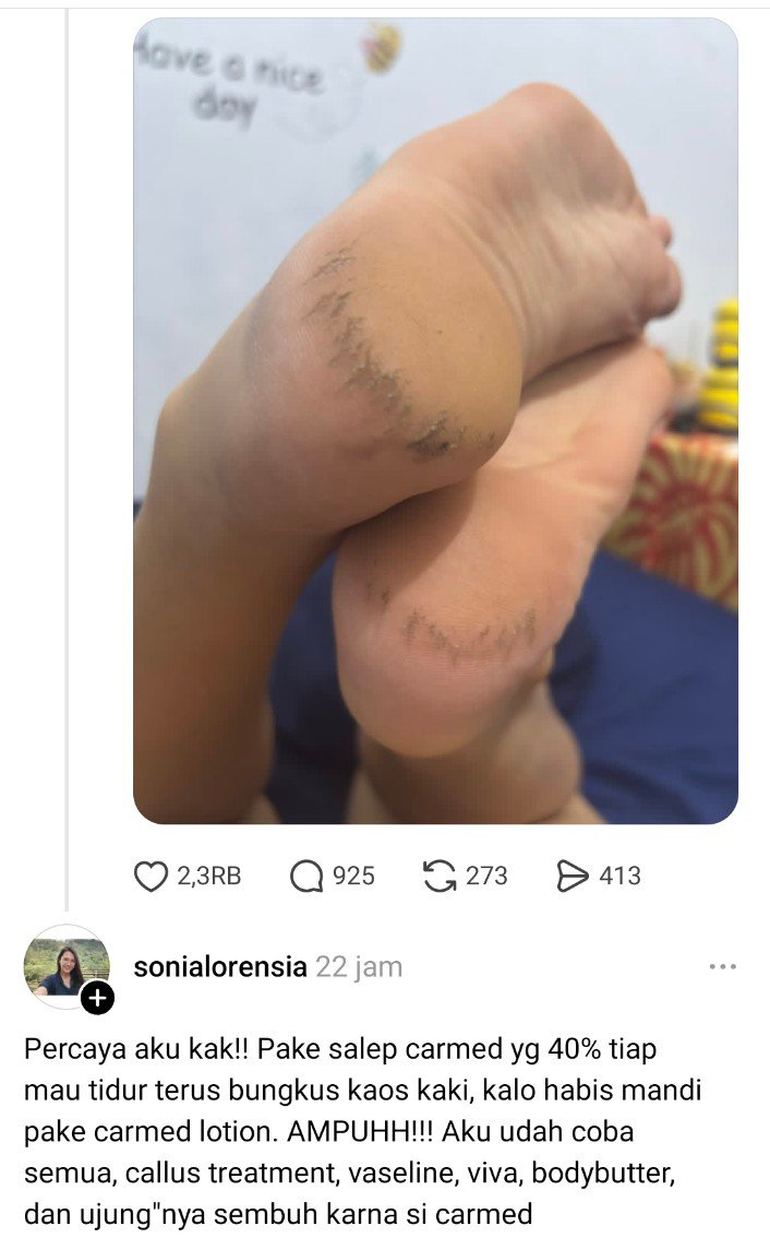 alkaromainy's tweet photo. Makasih banget kak spillan produknya, akhirnya nemu obat kaki pecah https://t.co/UlFm9hMmAs