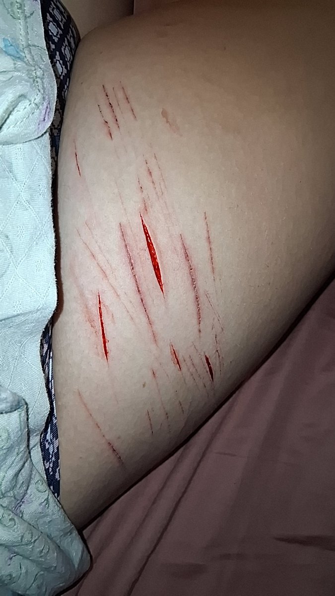 Frogsrsuperb's tweet photo. I usually use safety scissors but upped it to a face razor today, I want to go deeper #shtwt https://t.co/shopWj20Pc