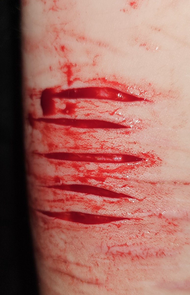 chud0101011's tweet photo. arm styros 🤤
all fake ai genarated sfx makeup for halloween not real  #shtwt #shedtwt #g0retwt #suicidetwt https://t.co/FkWDvqJ2aB