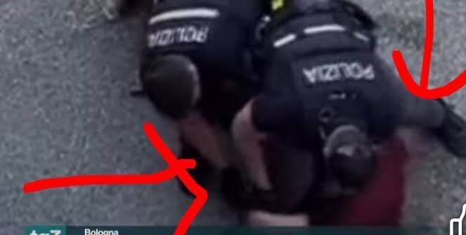 antipentac52268's tweet photo. Le compressioni toraciche, se eseguite secondo le linee guida BLS possono provocare la rottura delle costole nel 40-80% dei casi.
Conseguenze possibili: pneumotorace, emotorace, contusione polmonare, versamento ematico in sede polmonare fino alla lacerazione del fegato.
Quindi invece di gridare ancora “ASSASINI" agli agenti che stavano svolgendo SOLTANTO il loro lavoro, aspettiamo di conoscere la causa. 
Intanto, le prime risultanze dell'esame radiologico e autoptico non pone certo a favore delle "sentenze" di quei quattro strampellati faziosi, gli sciacalli, i terroristi rossi che continuano a puntare il dito sulla polizia e sul governo. 
Scusate, definirli sciacalli è riduttivo, ma non trovo altra definizione da poter utilizzare apertamente in pubblico. 
OSSERVATE COME IL POLIZIOTTO PER TUTTO IL TEMPO TIENE LA GAMBA E IL BRACCIO  ESTERNI PER SOSTENERE IL SUO PESO . SE SI GUARDA ANCHE IL VIDEO PER INTERO NON C È UN SOLO MOMENTO IN CUI SI POGGIA PIEGANDOLE .
QUESTA È UNA REGOLA SPECIFICA LEGATA ALLA MANOVRA PER IMPEDIRE E SCONGIURARE IL RISCHIO DI MAMCANZA DI ARIA.
NON È UNA POSIZIONE SPONTANEA MA STUDIATA.
L ALTRO POLIZIOTTO È SULLE GAMBE , IL PRIMO STA CERCANDO DI UNIRE I POLSI PER METTERE LA FASCETTA CHE IN SEGUITO  DOVEVA CONSENTIRE IL TRASPORTO E LO FA ESEGUENDO SCRUPOLOSAMENTE LA MANOVRA STUDIATA.
NON C ERA NESSUN MOTIVO NE INTENZIONE DI FARGLI DEL MALE.