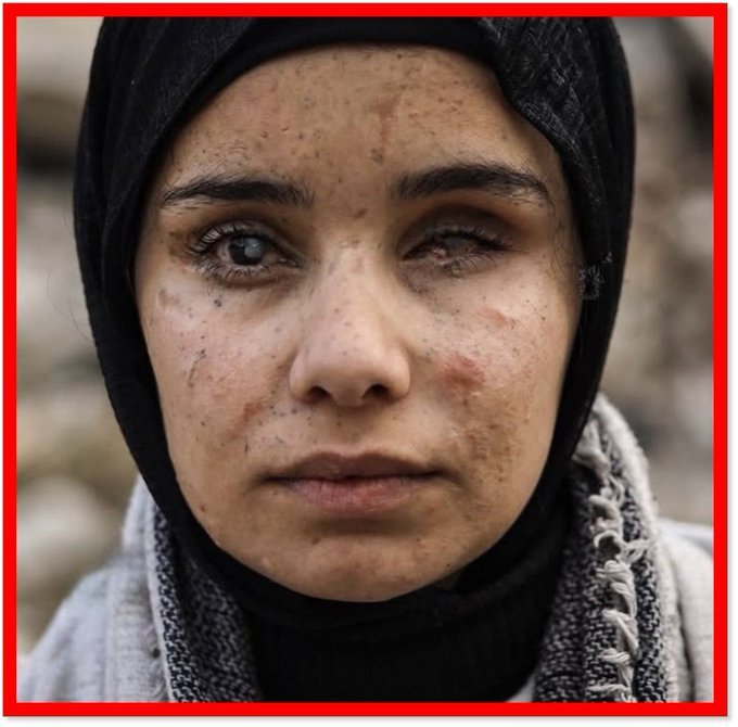 Galipilhaner's tweet photo. Bu konu daha önemli
Unutma UNUTTURMA
Filistin'de zulüm yeni başlamadı
ALLAH İsrail ve destekçilerini kahretsin
Oğuzhan Uğur Bilgilendirme https://t.co/jrggvI6VG2