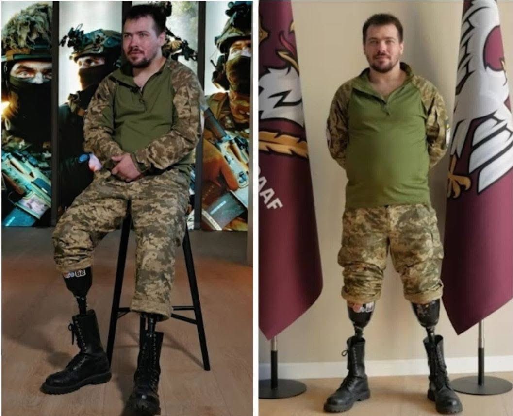 volodarskijo's tweet photo. Його тримали в клітці на морозі, а віддали по обміну, коли вже ноги почорніли.

29-річний Богдан Атаманський потрапив у російський полон і провів там десять місяців. 

Два тижні з них його тримали в залізній клітці просто неба - на морозі, який пробивав до кісток. Від холоду взуття примерзло до шкіри намертво. 

А коли ноги почали чорніти, росіяни погодилися віддати його на обмін.

У шпиталі Дніпра лікарям не залишилося вибору - довелося ампутувати обидві кінцівки.

Але це ще не кінець історії. Це тільки початок.

Після реабілітації Богдан не просто навчився ходити на протезах - він відновив фізичну форму до того рівня, що став тренуватися на біговій доріжці. 

А потім зробив те, що багатьом здається неможливим: він повернувся до лав Збройних сил України.

Полон забрав у нього ноги. Але не забрав волю воювати далі.

Людина-сталь. Людина-приклад.