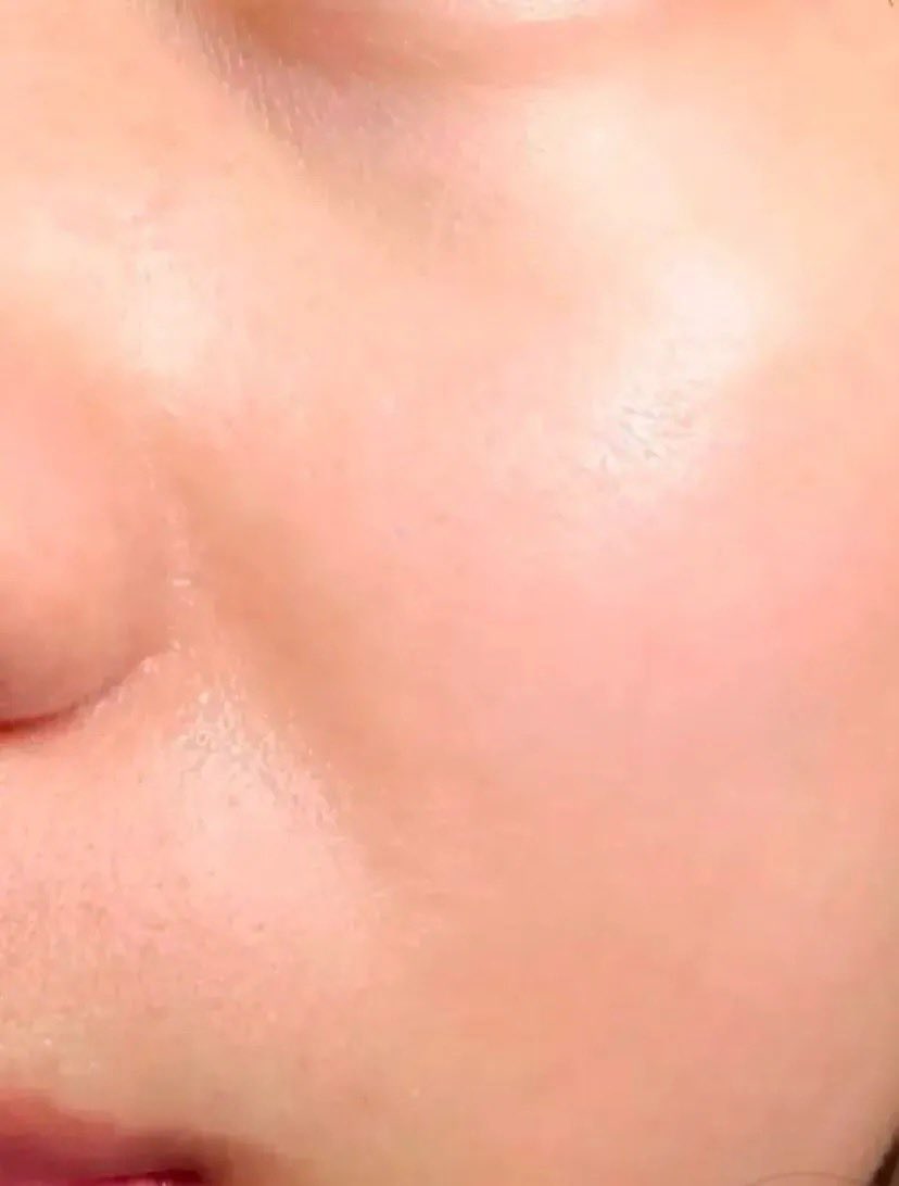 nadaeladela's tweet photo. Saran dari dr. SPKK 😭🙏

Ternyata selama ini banyak yang salah exfoliasi bukannya bikin bagus, malah bisa hancurin skin barrier ��🥲
Kalau ga paham cara pakainya, mending STOP dulu.

Begitu dipake dengan cara yang bener, baru kerasa bruntusan pelan-pelan hilang tanpa perih, tanpa drama. Kulit jadi jauh lebih tenang.✨￼