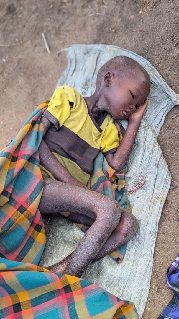 Jamila550337's tweet photo. @TruthTrumpPost Mr president these people are from Uganda karamoja region Uganda government is mining gold and diamonds from that region m7 who’s ruling Uganda by force rigged elections recently he said Uganda is a paradise look at the people who live in the paradise 😭😭 https://t.co/GtnQOVvfOB