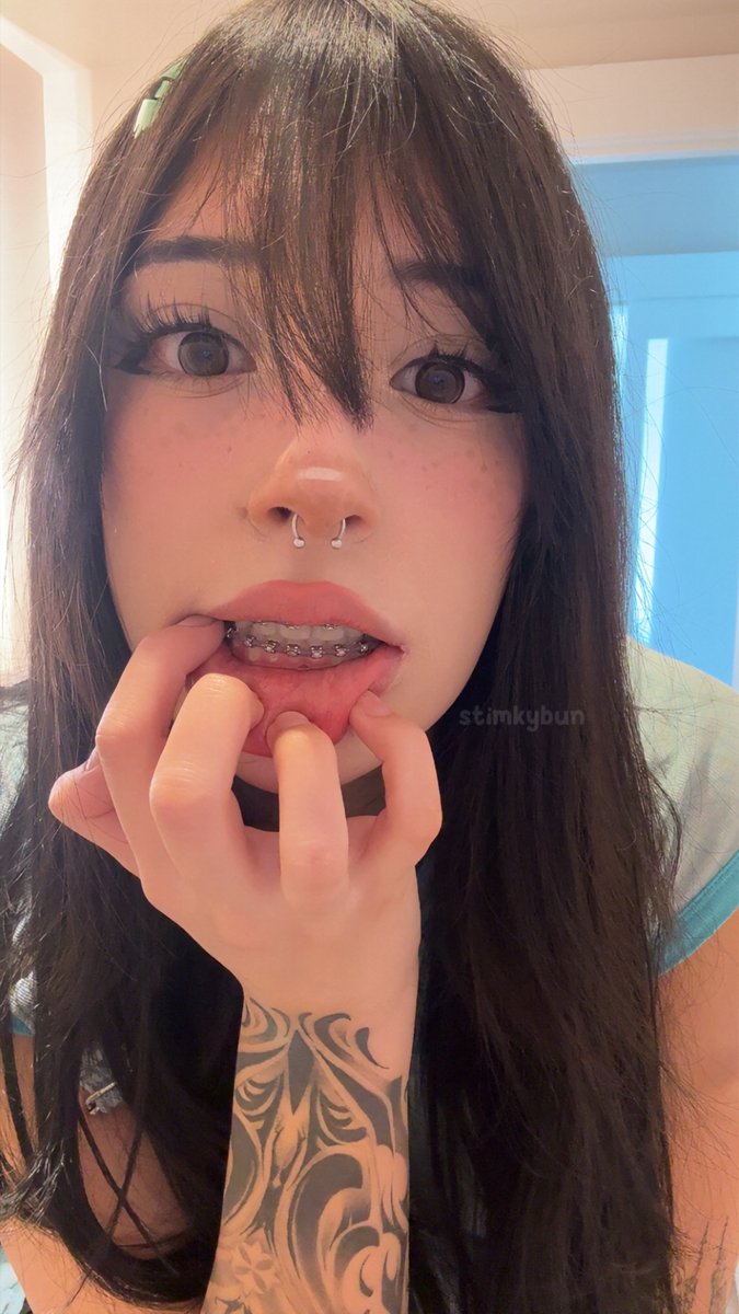 stimkybunsie's tweet photo. could use some whitening https://t.co/Eba2vcTT47