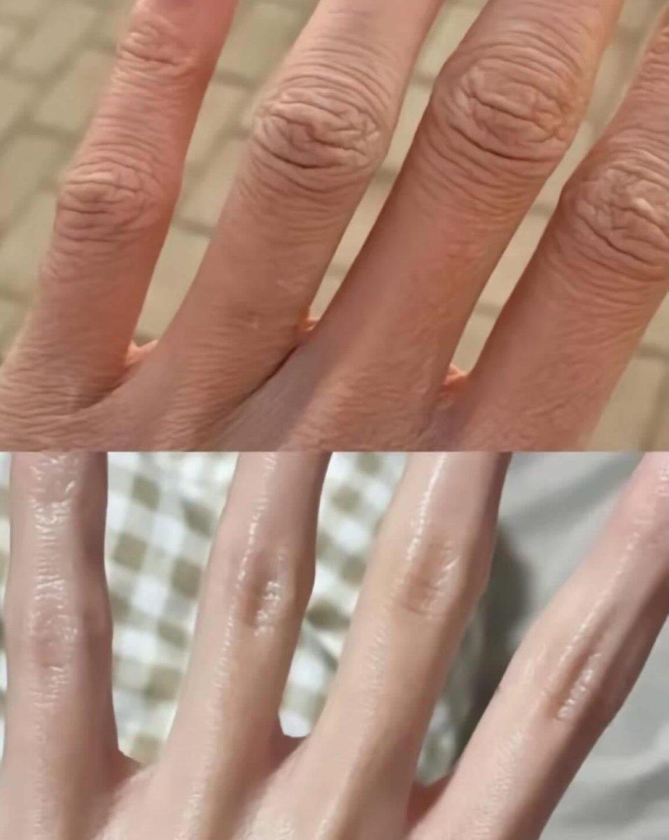 abtjanuary's tweet photo. akhir-akhir ini rutin pake hand cream retinol dan tangan terasa lebih lembap, halus, serta lebih terawat https://t.co/EzT68cPhiH