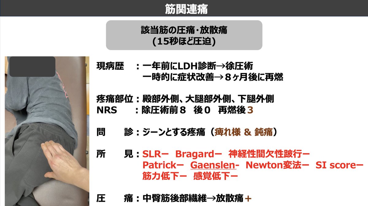 mori_pt_gbc's tweet photo. セラピストドットコム様のセミナーに登壇させていただけることになりました🙇🏻‍♂️

・難渋する下肢痛を3病態から整理したい
・神経症状を伴わない下肢痛への対応力を高めたい 
・改善しきれない症例への対応力を高めたい

という方に向けてお話しします！

参加登録はこちらから！
https://t.co/gOFtTNJGDk https://t.co/tW3Vn4FC0I