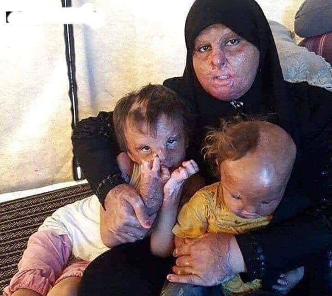 MUBEE9451's tweet photo. Yemen on 17/5/2016.
May God curse the Al Saud in their entirety. https://t.co/MM3omK6gsz