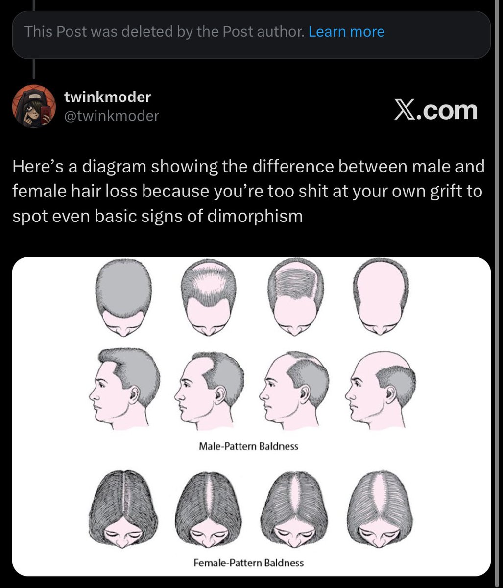 twinkmoder's tweet photo. How every interaction with terfs goes for me https://t.co/K60ztpX0D6