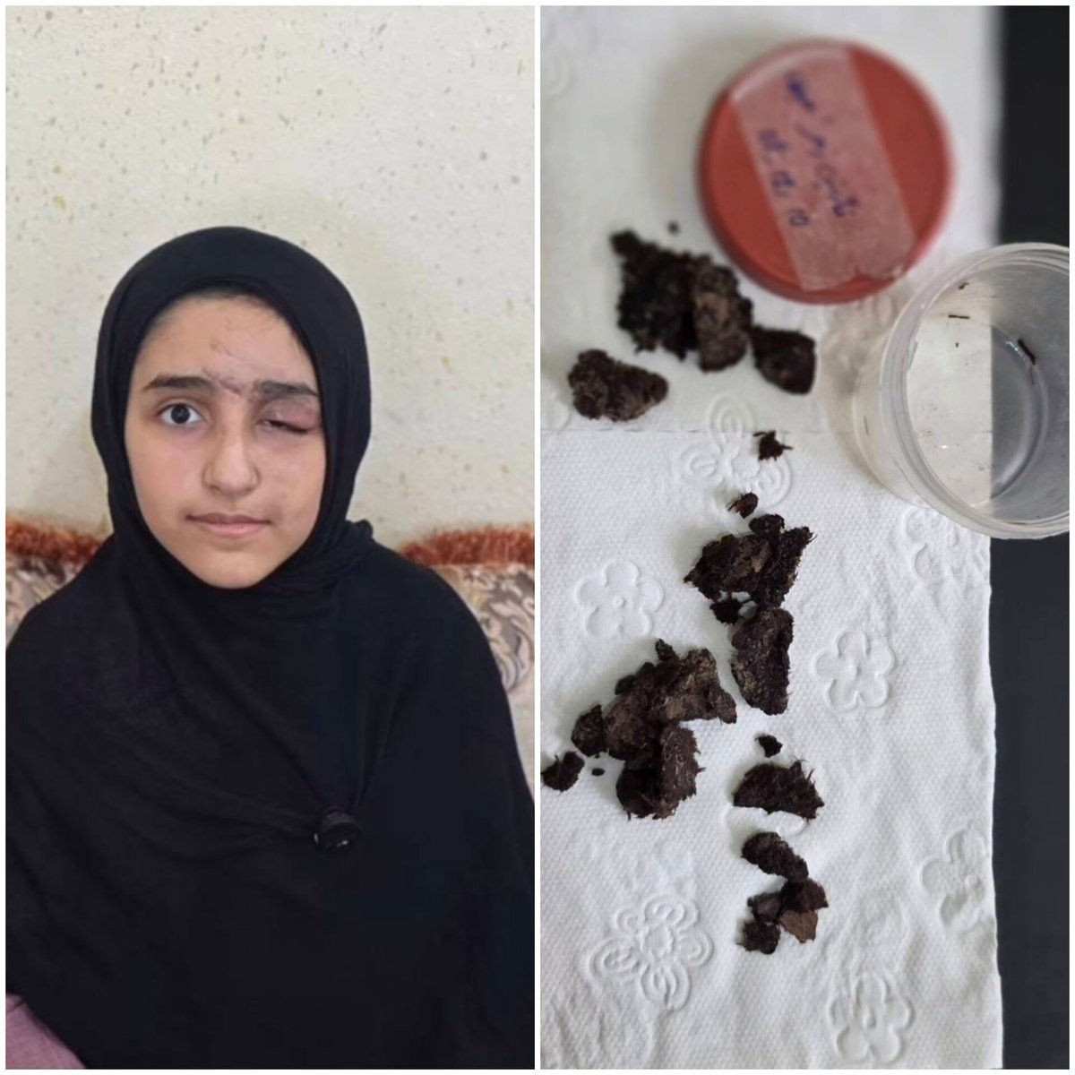 neda87311's tweet photo. درسته اینهمه ترکش از چشمت در آوردن ،ولی هنوزم خوشگلی نازنین خانوم 😍 https://t.co/K6T9fpLGog