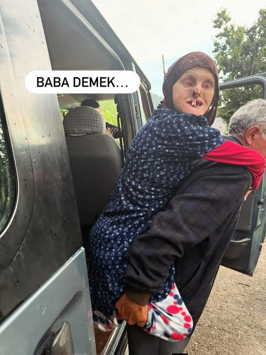 TOPRAK_2_'s tweet photo. Baba demek neydi ..?
27 yaşındaki Rabia’yı,5 yıl kucakta 22yıldır da sırtında taşımaktı.
Ne bir gün sızlandı, ne bir kez yorgunum dedi.
Baba demek, sessizce ağlayan yürek demekti…
Baba demek, sadece yükü değil evladını da omuzlayan demekti…
Belini büken evlatsa, dimdik yürümekten daha onurludur suskun yürüyüşü…
Baba demek; “ben iyiyim” deyip gözyaşını içine akıtmak demekti.
Ve Rabia demek; bir babanın ömrü boyunca hiç bırakmadığı can parçası demekti…Hayatta olan babalara sağlıklı huzurlu bir ömür;Ahirete intikal eden babalara ise Allah’tan rahmet ve evlatlarına sabır diliyorum…