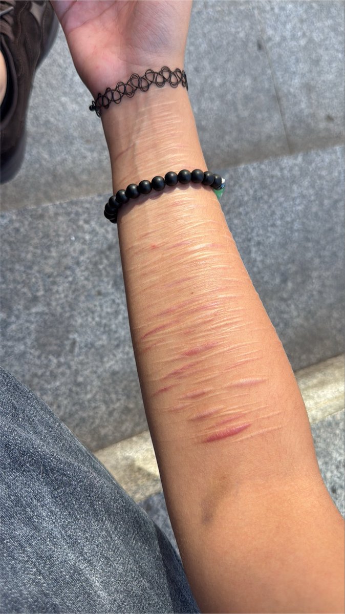 3nkai70648's tweet photo. They are healing… i still feel like they are not enough. Wtf is wrong with me i was healing… https://t.co/nsl7uNkgYH