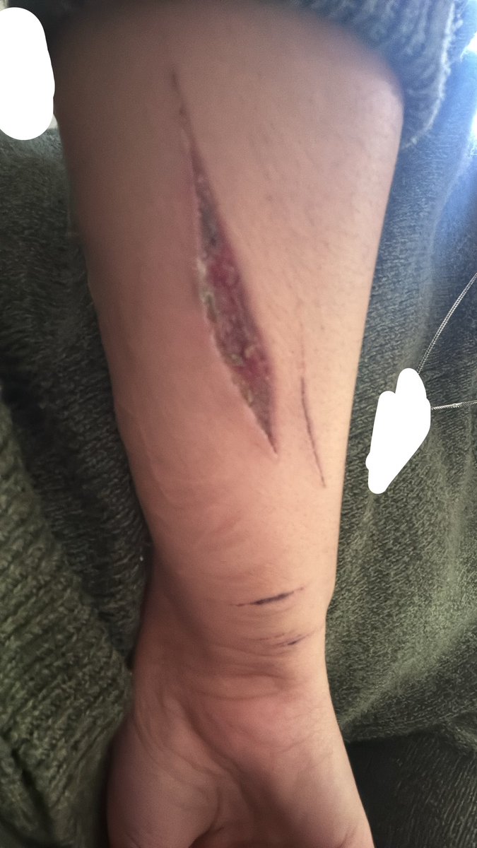 mumsomii's tweet photo. atleast this is healing!!
fake
drawing makeup
#healing #shtwt #sharm #fyp https://t.co/s3VbocwKpf