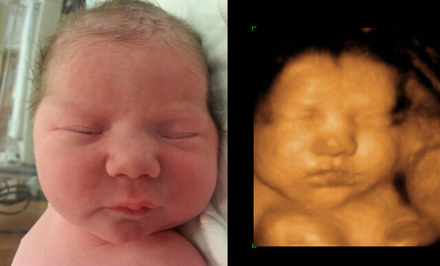 KristanHawkins's tweet photo. So many say, “I’m not ready to have a baby.”  

But somehow, they’re ready to end that baby’s life.  

That decision is permanent.  

That child will never come back.  

You’re not just changing your life, you’re erasing someone else’s entire future. https://t.co/c5xjOfQs4G