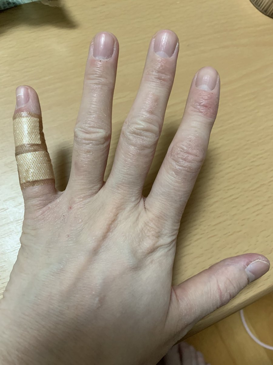 rikai46's tweet photo. 寝てる間に痒くて掻いても傷ができずに耐えてくれてる・・・皮膚の感じが全然違うよ https://t.co/ZQebA66O0e