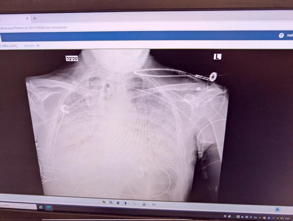 rukiruto's tweet photo. 🚨🚨 A bit of personal news: I've been out of action for three months after a surprise lung infection took me down.

Couldn't even read or write, let alone follow the markets. Sorry for going quiet—I'm finally healing and stoked to jump back in. https://t.co/CyLZ2oMpQU