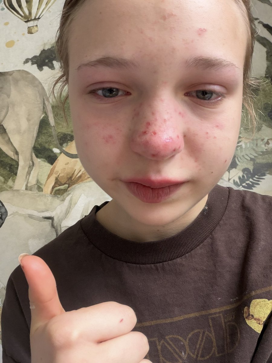 lSillytwt's tweet photo. Looking in the mirror after going from bmi 16.7 to bmi 17.7 (it’s not poop weight I lax purged) for no reason at all in ONE WEEK #edrtwtㅤ https://t.co/3ficDHmZnm