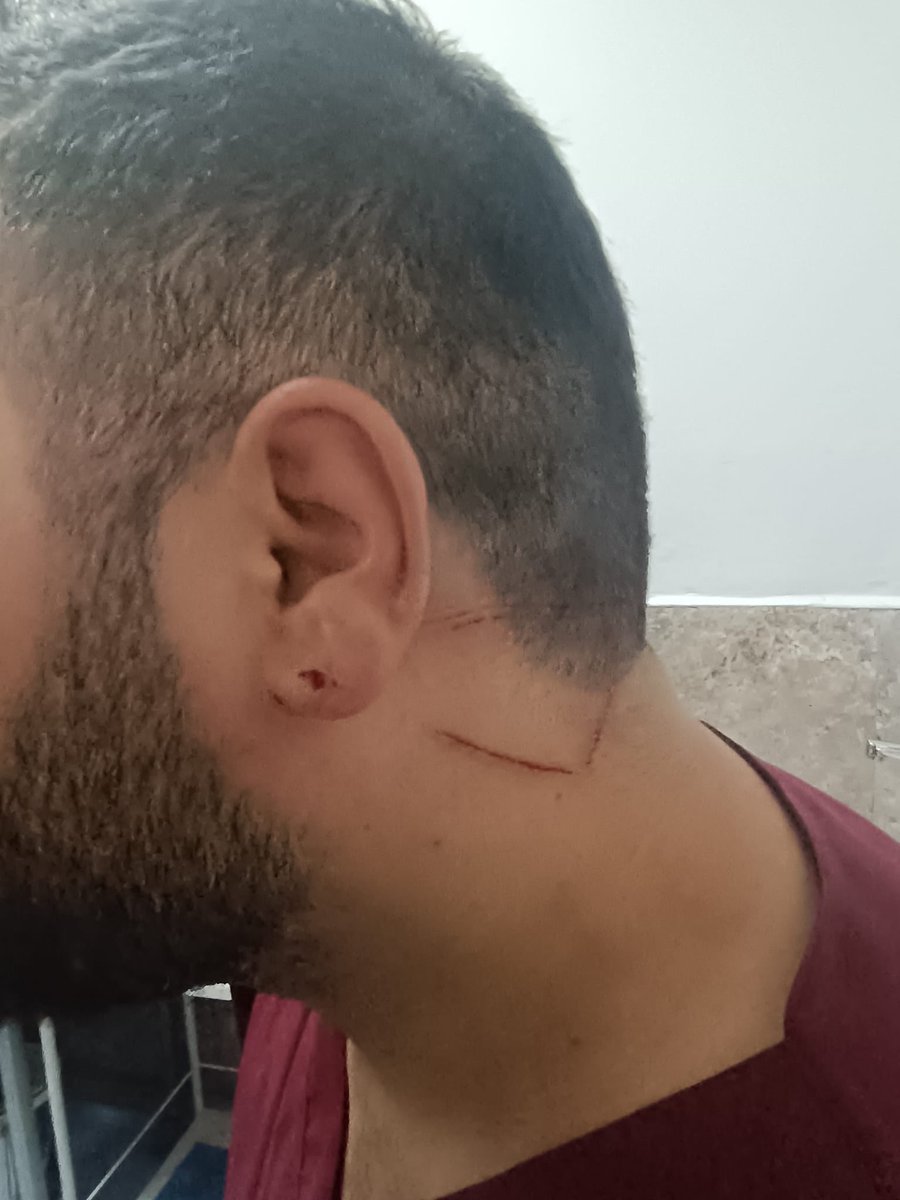 abdulkadiryabir's tweet photo. Şanlıurfa Eğitim ve Araştırma hastanesinde görevli sağlık çalışanı arkadaşımız bugün bir cani tarafımdan saldırıya uğramıştır. Sağlıkta şiddet bir insanlık suçudur.Sorumluların en ağır cezayı alması için sürecin takipçisi olacağız.@hasansildak @sanliurfaism https://t.co/xzofvsekoz