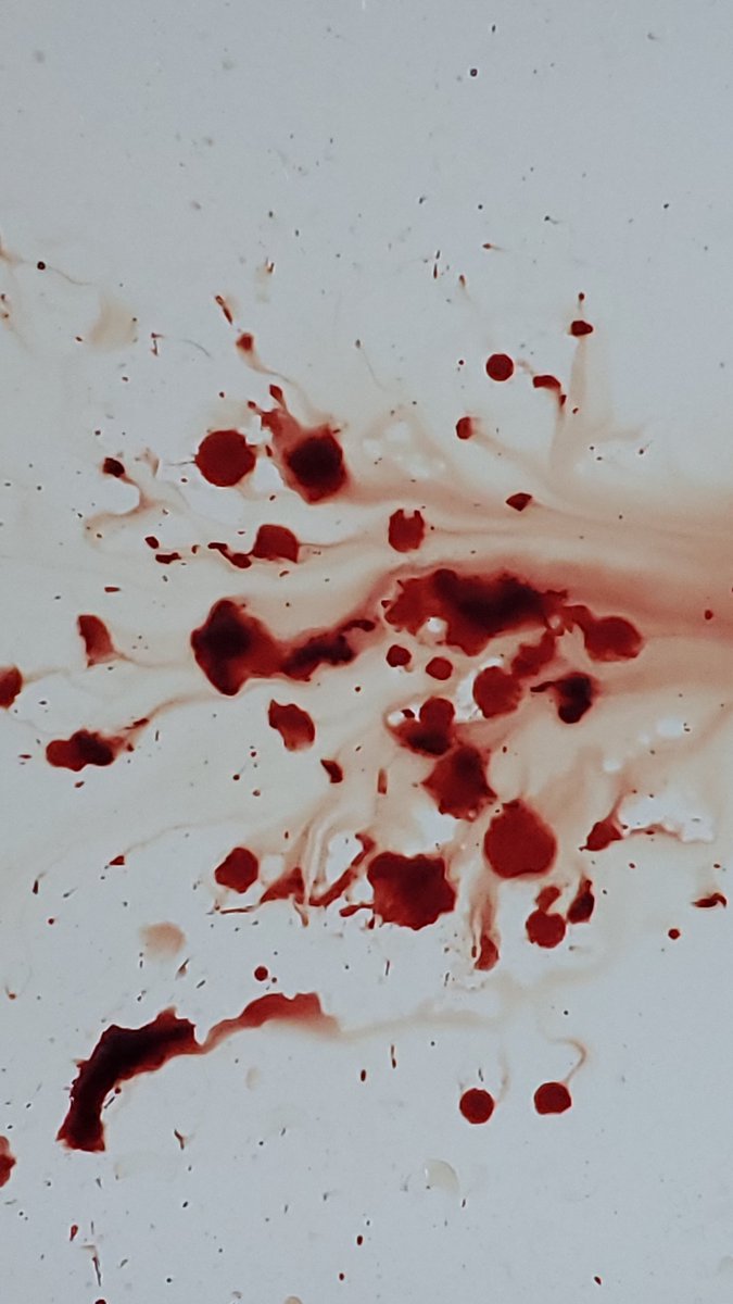 Naos0a's tweet photo. ALL FAKE SFX MAKEUP AI GENERATED NOT REAL AND NOT PROMOTING SELF HARM

I think I finally hit a deeper styro? Not sure tho cuz I had to put a bandage so I'll see later 😝
(I still had to get drunk to cut deeper ugh) https://t.co/Nkt3ssa12S
