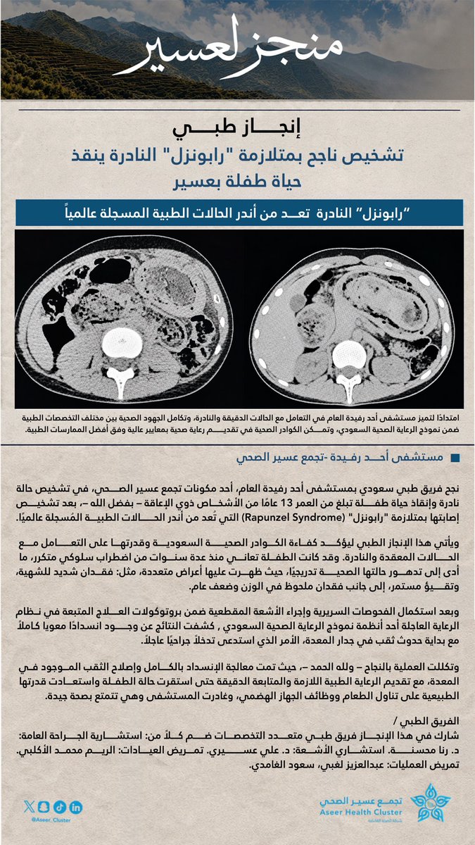 Aseer_Cluster's tweet photo. #منجز_لعسير
#كفاءات_سعودية 
بفضل الله، تمكن الفريق الطبي بمستشفى أحد رفيدة  أحد مكونات #تجمع_عسير_الصحي – في تشخيص متلازمة “رابونزل” النادرة وإنقاذ حياة طفلة، في إنجاز يجسد كفاءة الكوادر الطبية وتكامل التخصصات لتقديم رعاية صحية وفق أعلى معايير الجودة. https://t.co/tVhwwxvjxr