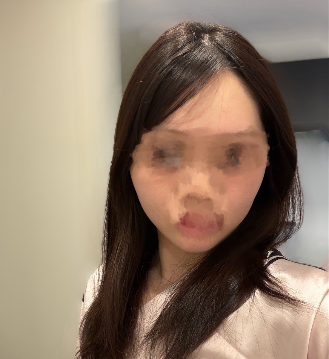 f_q9sw's tweet photo. 脂肪吸引してからふとした時の適当に撮った写真でも、顔でかー、輪郭終わりやなて病むこと少なくなった🥹次顎下もやりたいなー😮‍💨
@sharpps_jp https://t.co/OqsksqwNCj