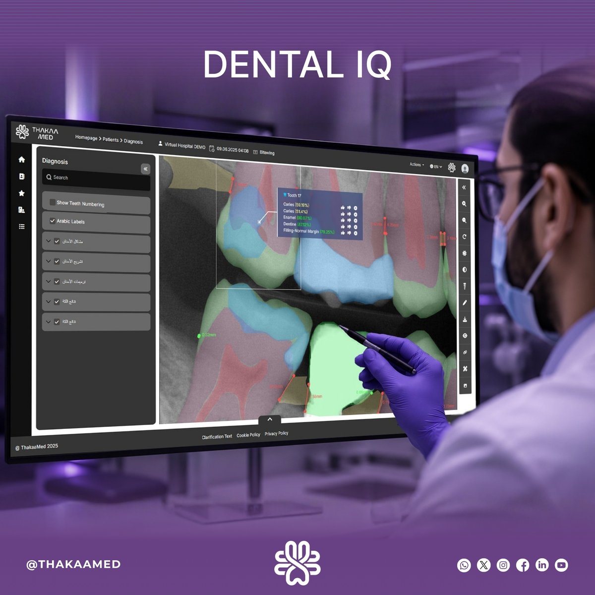 Thakaamed's tweet photo. One scan. Every finding. Seconds.

While you're still reading the X-ray, Dental IQ has already mapped every condition, measured every detail, and flagged what needs attention first.

What does your diagnostic workflow look like today?

#DentalAI https://t.co/LbCh7LzBCx
