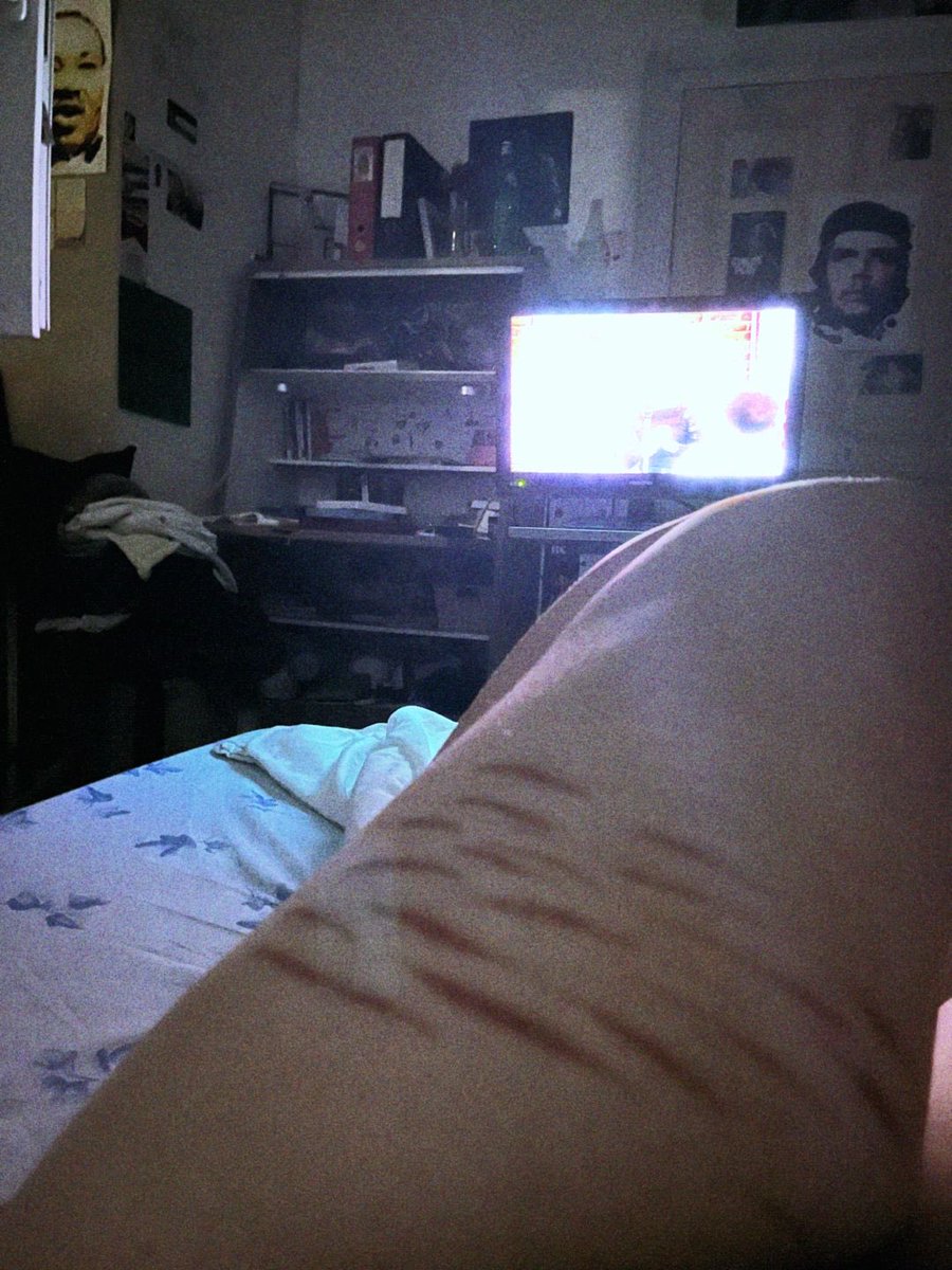 Amyygit1y's tweet photo. ALL FAKE ALL MAKEUP FAKE BODY
I'm doing so badly, I have such a strong urge to cut myself again. But I can't my boyfriend is going to leave me. I feel so lonely :( https://t.co/kHEKmIvBgO