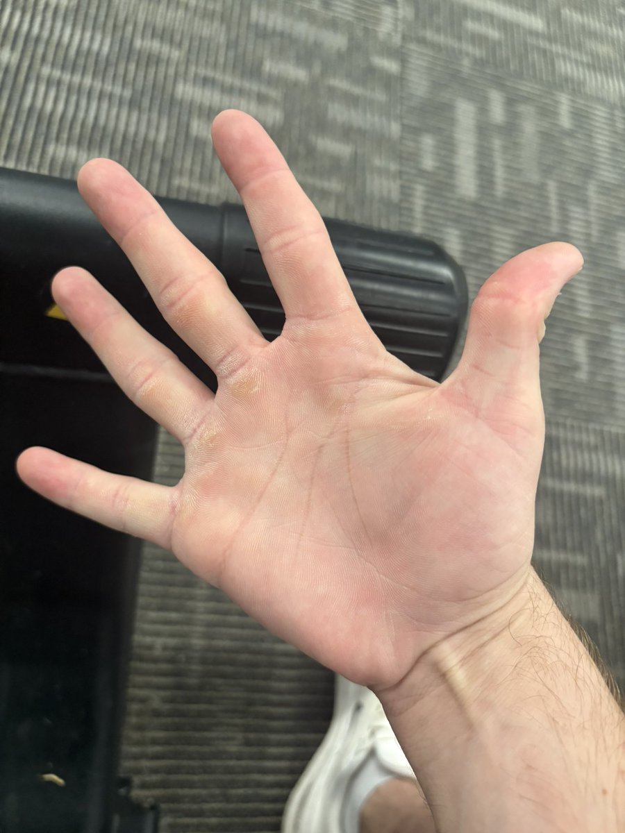 SheClap4Sosa's tweet photo. 400 follower right hand dox!  I would kill with this bare hand for each and every one of you #clamnation https://t.co/zsx15YlQvW