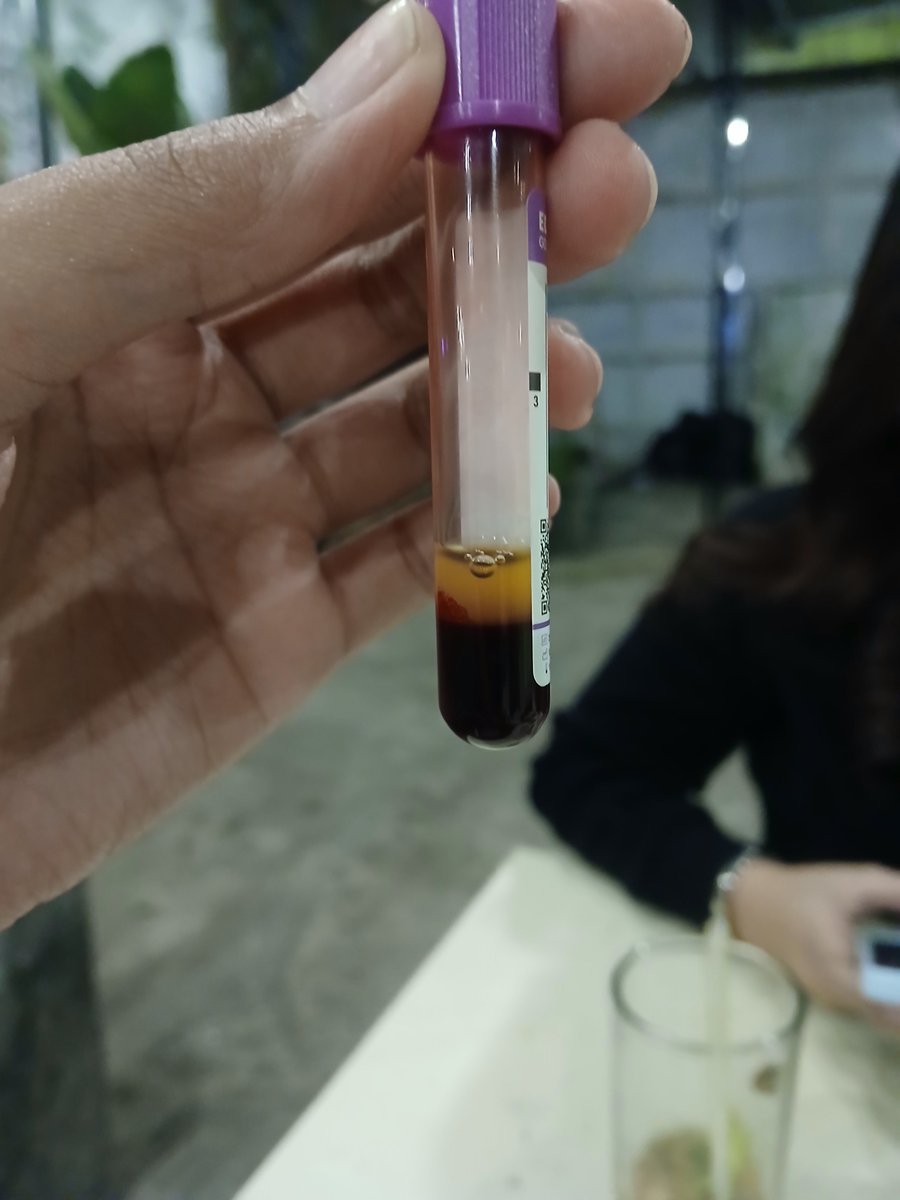 sheyaec's tweet photo. satnight activity💉 https://t.co/uUQK8ay0tj