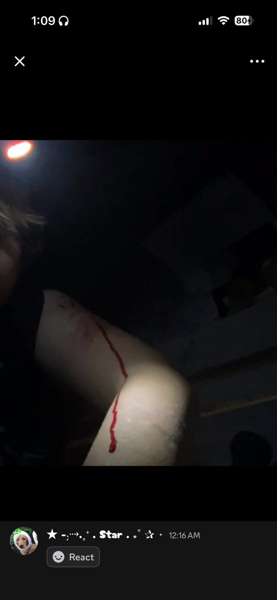imcooked2438's tweet photo. FAKE SFX NOT REAL!! THIS IS MAKEUP https://t.co/hrK7uBNGCt