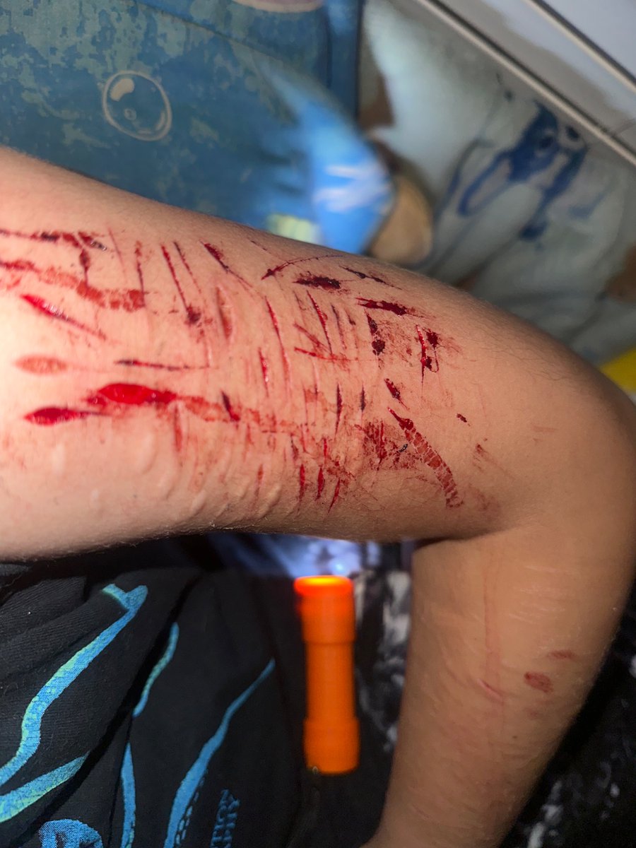 imcooked2438's tweet photo. FAKE SFX NOT REAL!! THIS IS MAKEUP https://t.co/hrK7uBNGCt