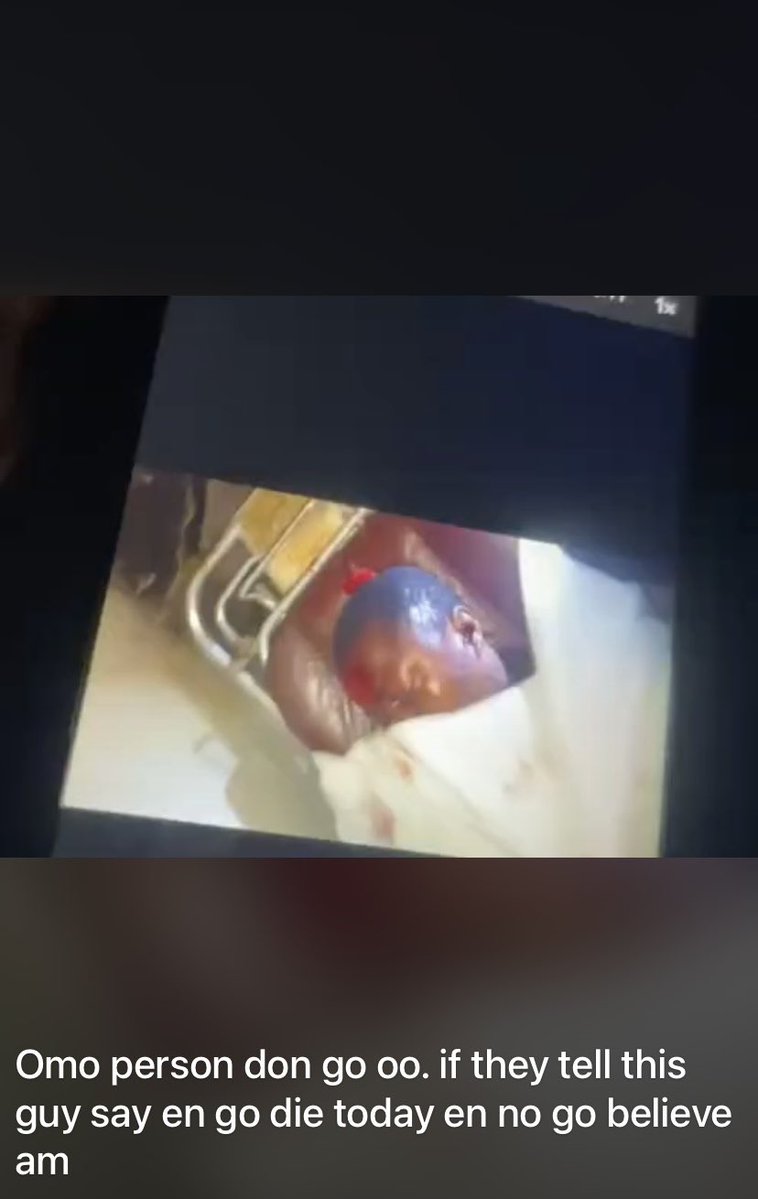 ogaAloy's tweet photo. How do you go about doing car drifting in a school environment??
What kind of a nation is this?
How do people live life like this 🤦

Now a life is lost 😞 
This happened at IMSU in Owerri! https://t.co/dNh61rUUHJ