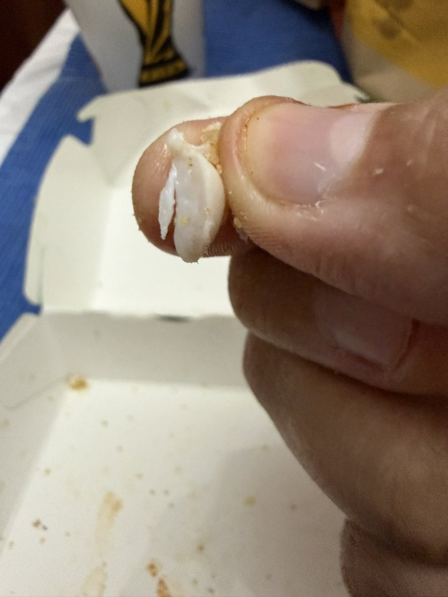 germanspinzon's tweet photo. @McDonaldsCol me salió un HUESO en un nugget! 🤢🤢🤢 https://t.co/V4Lti6jP1H