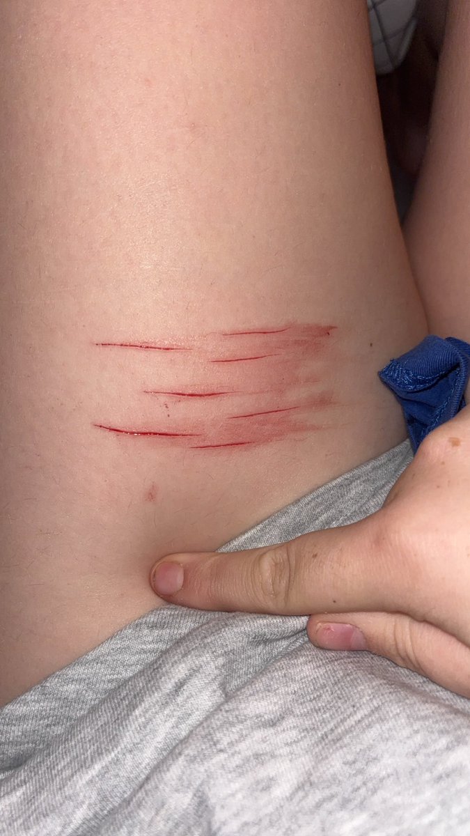 Lilaec_'s tweet photo. All fake Halloween sfx makeup!! Bby Styros I think? #shtwt https://t.co/PRUCpuJJjy