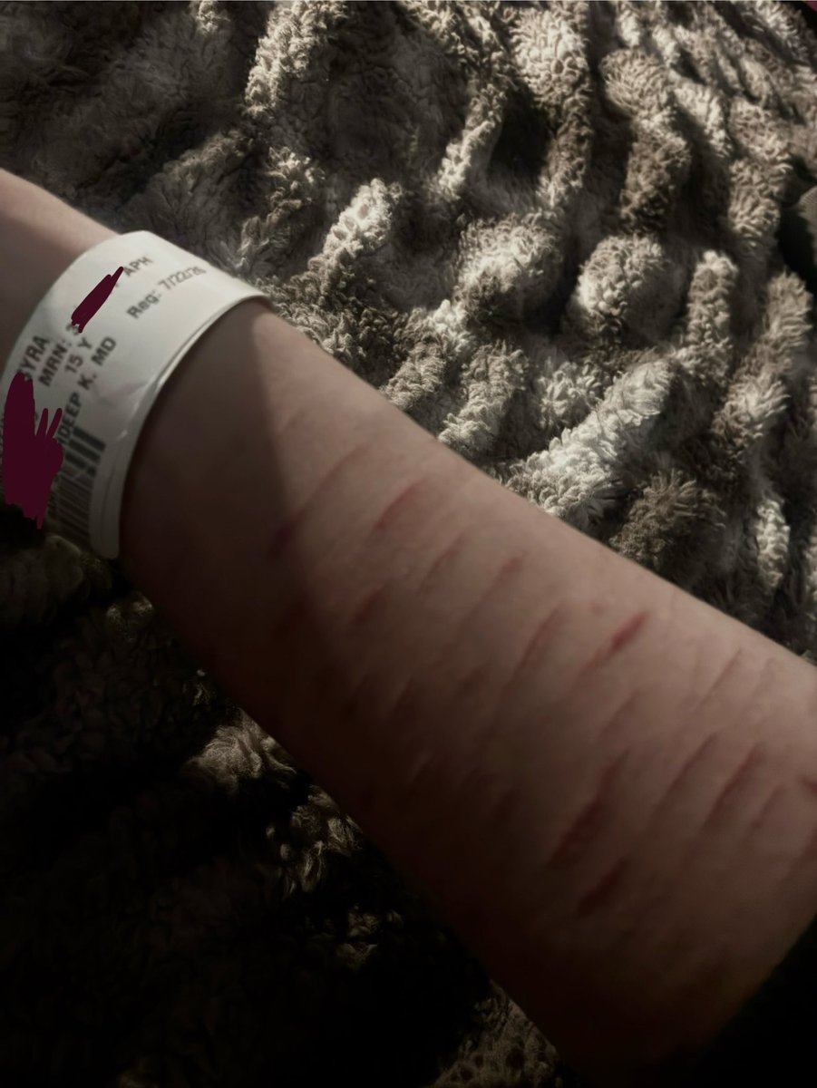 Syalt236's tweet photo. Did anyone miss me, I overdosed and they charcoled me and sent me to a psych place, I’m so mad abt what’s been going down and how much things changed I really don’t wanna keep doing this #shtwt https://t.co/uQbBxnJTCL