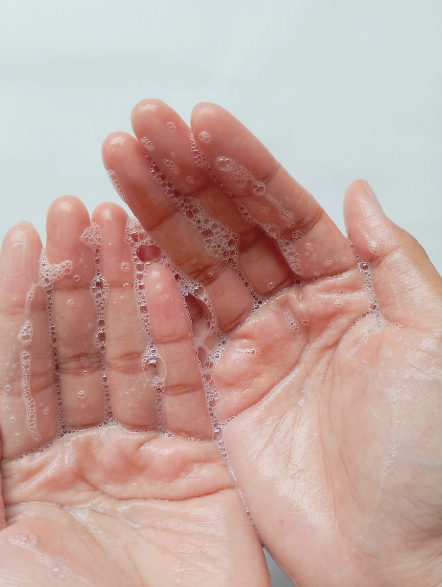 Riska17's tweet photo. acne gentle face wash + oil free brightening moisturizer, kedua skincare ini kuncinya!

face wash dgn busa ringan, yg afternya bener² fresh, bersih &amp; ga bikin kulit ketarik.
setelah beberapa kali pake, jerawat aku udah mulai reda, sekarang tinggal bekasnya. https://t.co/4VAdeQ9A1u