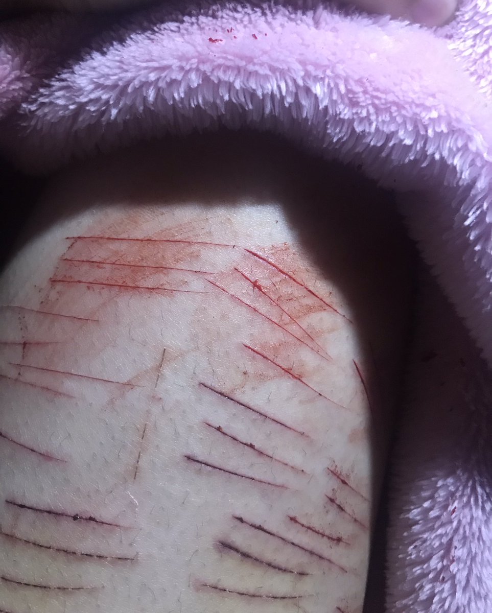 bunniebuttt's tweet photo. sorry mom 🐰
#slittwt #988twt 
sfx makeup, not real https://t.co/w23i3N9FXh