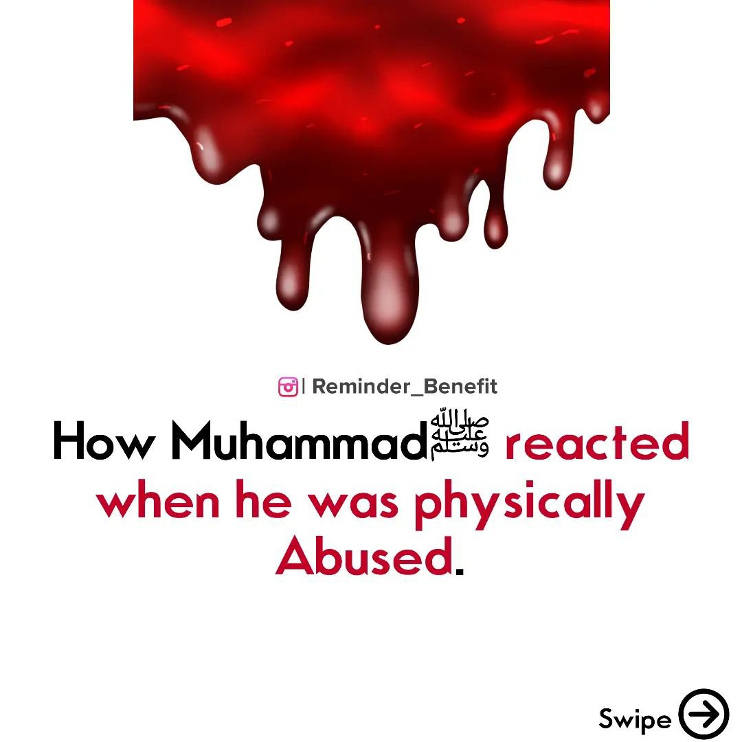 7signxx's tweet photo. How the Prophet Muhammad ﷺ Reacted When He Was Physically Abused... 

THREAD https://t.co/PEOi7dFYUl