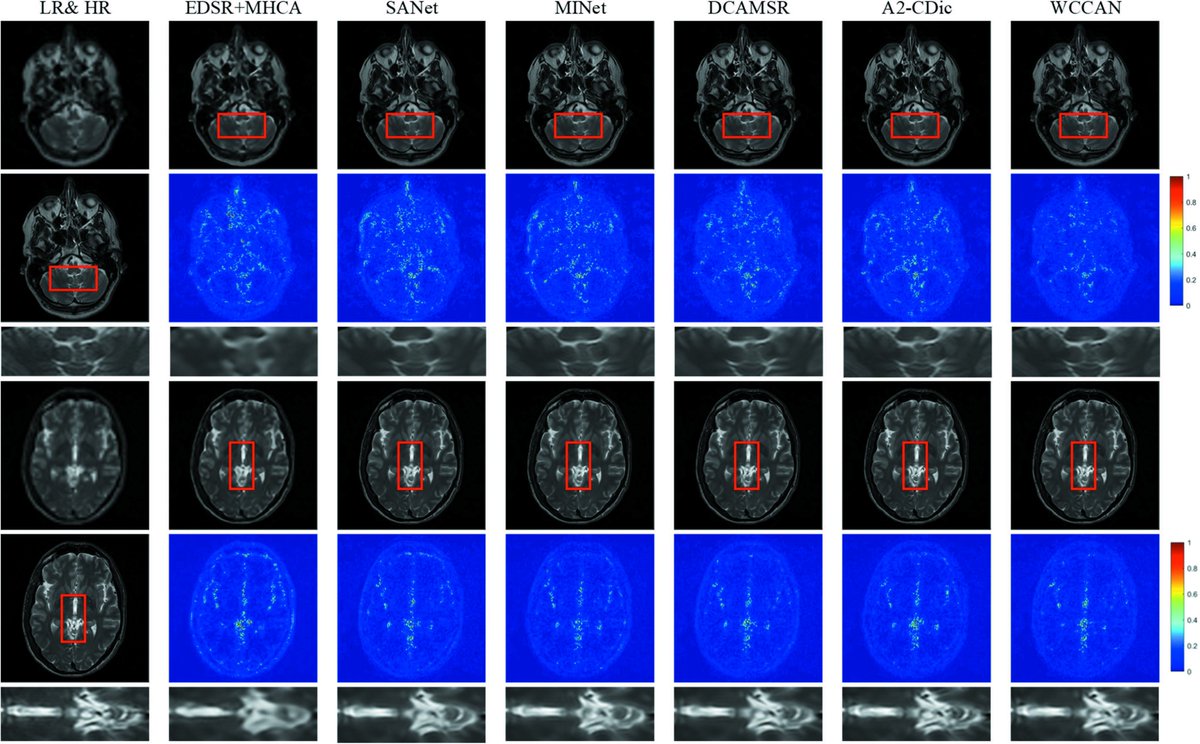 in_magnetic's tweet photo. Advance Publication
WCCAN: Windowed Cross-contrast Attention Network for Multi-contrast Brain MR Image Super-resolution https://t.co/tLcbfUtyjb https://t.co/OClfjObKYs