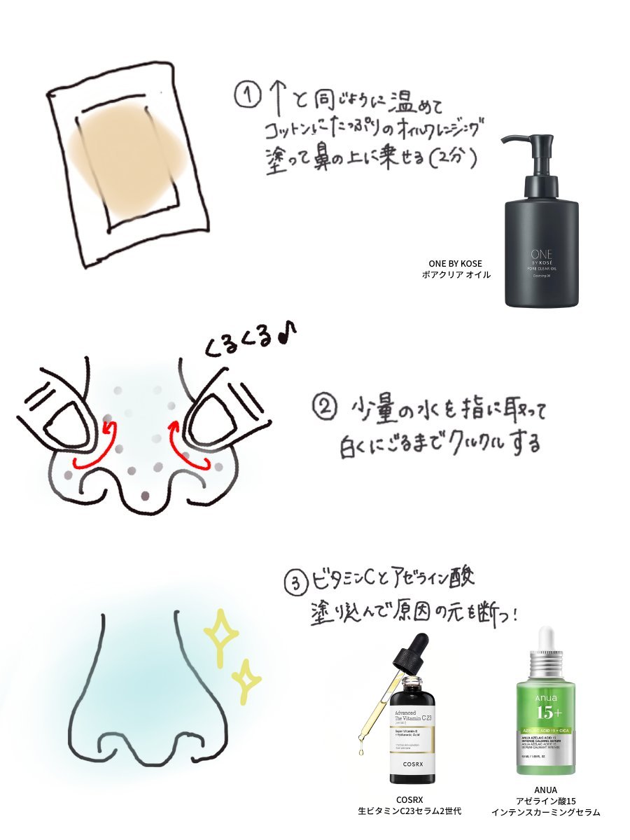 kikiq28's tweet photo. メラニン毛穴と黒ずみ毛穴でケアのやり方が違います！！

⚪️メラニン毛穴とは
→ 毛穴の縁が、紫外線や摩擦などの刺激によって色素沈着したもの
（毛穴周りが茶色っぽい）

⚪️黒ずみ毛穴とは
→角栓が空気に触れて、表面だけが「酸化」して黒くなったもの
（毛穴の中が黒いポツポツ）

私はこのやり方でいちご鼻と決別できた✍🏻
メラニン毛穴→黒ずみ毛穴