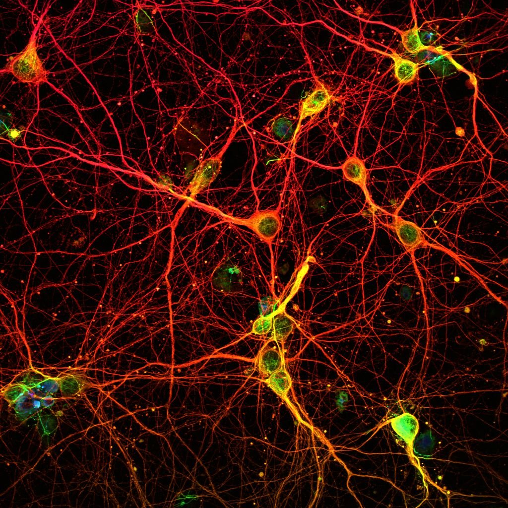 latestincosmos's tweet photo. 🚨: Research shows when you focus on the good, your brain trains itself to fing more of it. https://t.co/jV1ilrz6YB