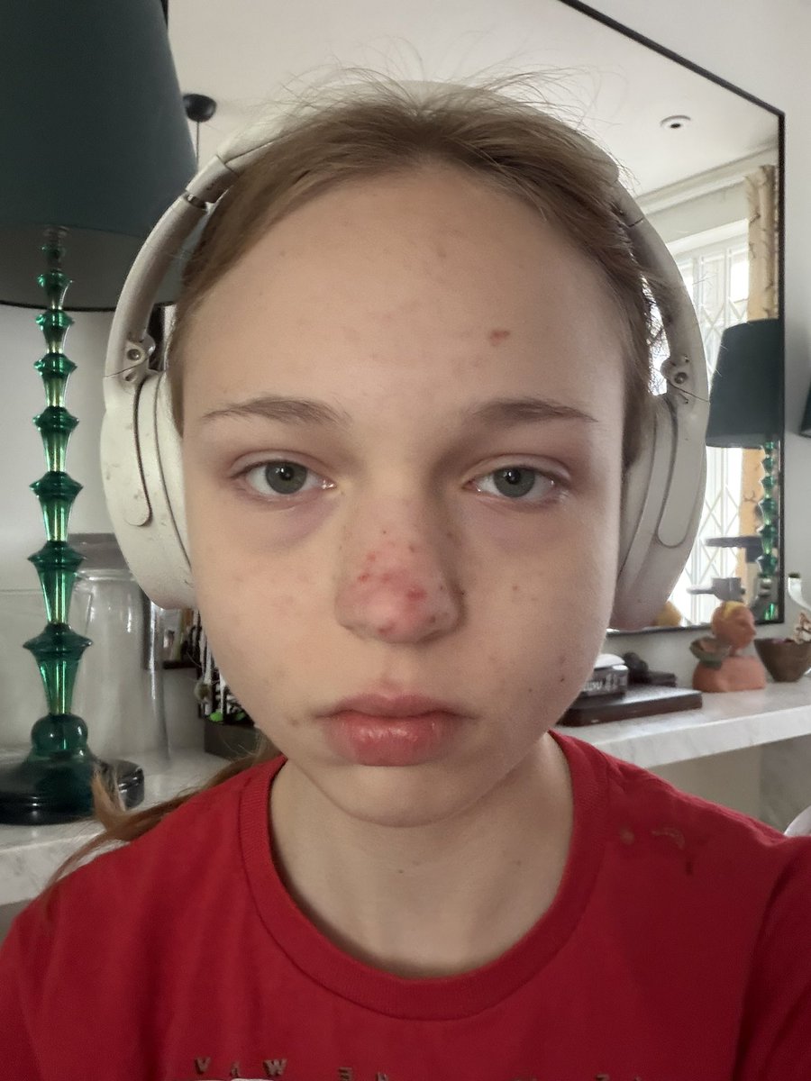 lSillytwt's tweet photo. 46kg I’m such a fat fucking chud I’ve actually gone up 3kg this week I cry every day and then just feel empty. 

I think I have Mia cheeks bro https://t.co/WFHbbSFuxn