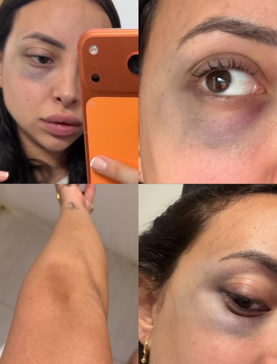 Vía Szeta tweet media