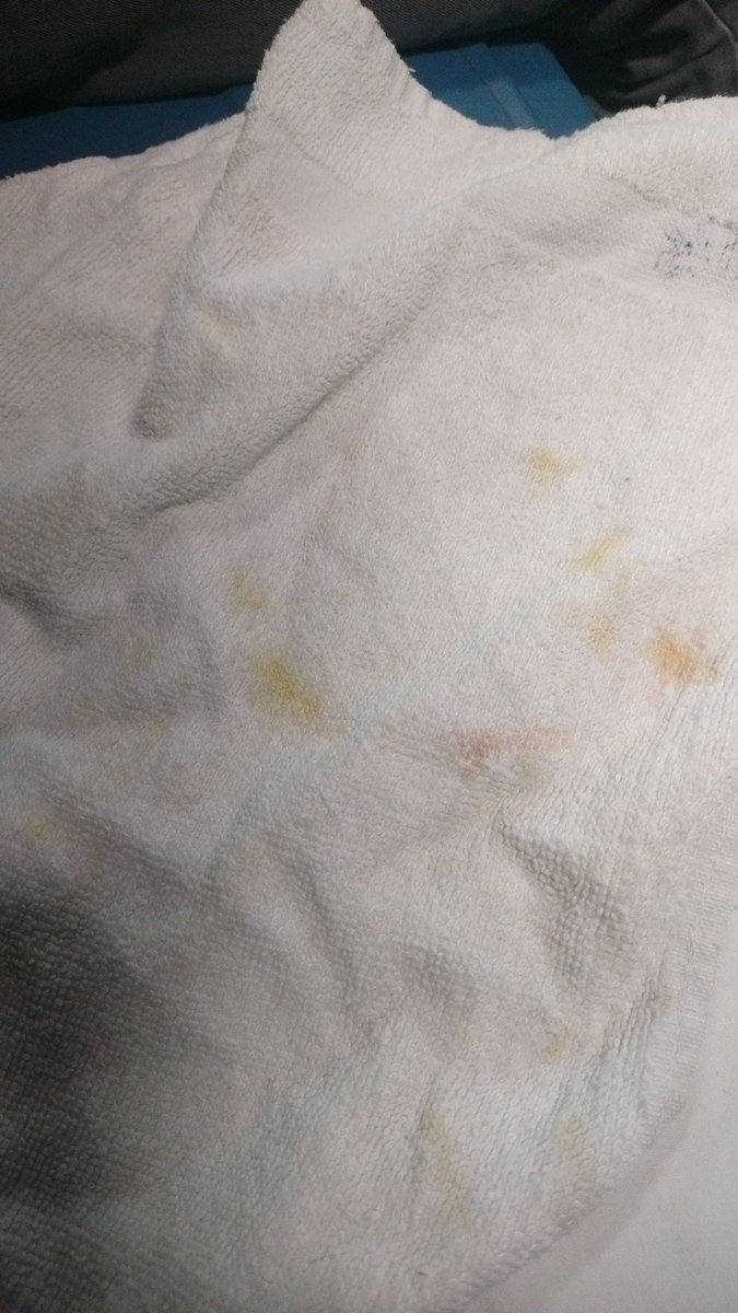 Aasssindore's tweet photo. @RailwaySeva @RatlamDRM  such kind of dirty tovel je being provided in the train. I'm traveling 12962 Awantika express , berth no A1/13 https://t.co/r56asAKyo0