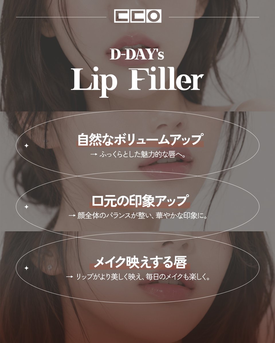 ddaybusan_jp's tweet photo. ||◤ 唇フィラーｘ 口角ボトックス ◢||

💋✨ 理想のリップは、バランスが大切。

唇フィラーと唇ボトックスを組み合わせることで、 
より自然で美しい口元へ。

💎 ふっくらとした立体感 
💎 縦ジワを目立ちにくく 
💎 自然で魅力的なリップライン 
💎 お顔全体のバランスに合わせたオーダーメイド施術

「やりすぎない、自然な美しさ。」
 D-DAY CLINICでは、
お一人おひとりに合わせたリップデザインをご提案いたします✨

📩 ご予約・お問い合わせはLINEからお気軽に。

#韓国 #韓国情報 #韓国旅行 #韓国旅行情報 #韓国美容 #渡韓美容 #渡韓 #渡韓情報 #韓国美容皮膚科 #美容クリニック #dday医院 #釜山 #釜山旅行 #釜山美容 #釜山情報 #韓国肌管理 #韓国皮膚科 #韓国好きな人と繋がりたい