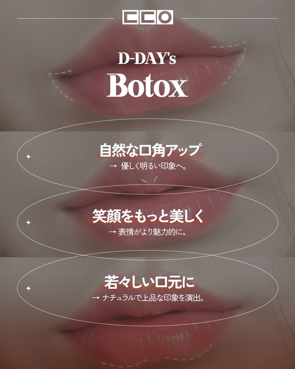 ddaybusan_jp's tweet photo. ||◤ 唇フィラーｘ 口角ボトックス ◢||

💋✨ 理想のリップは、バランスが大切。

唇フィラーと唇ボトックスを組み合わせることで、 
より自然で美しい口元へ。

💎 ふっくらとした立体感 
💎 縦ジワを目立ちにくく 
💎 自然で魅力的なリップライン 
💎 お顔全体のバランスに合わせたオーダーメイド施術

「やりすぎない、自然な美しさ。」
 D-DAY CLINICでは、
お一人おひとりに合わせたリップデザインをご提案いたします✨

📩 ご予約・お問い合わせはLINEからお気軽に。

#韓国 #韓国情報 #韓国旅行 #韓国旅行情報 #韓国美容 #渡韓美容 #渡韓 #渡韓情報 #韓国美容皮膚科 #美容クリニック #dday医院 #釜山 #釜山旅行 #釜山美容 #釜山情報 #韓国肌管理 #韓国皮膚科 #韓国好きな人と繋がりたい